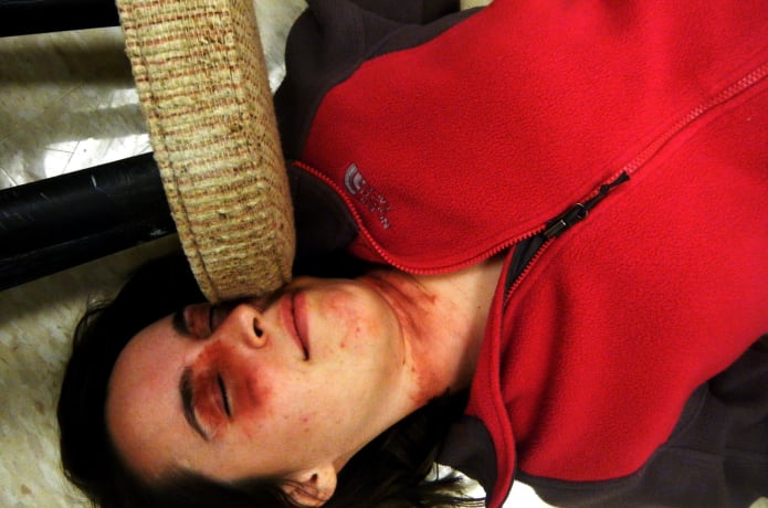 Ligature strangulation wounds in a mock crime scene investigation scenario.