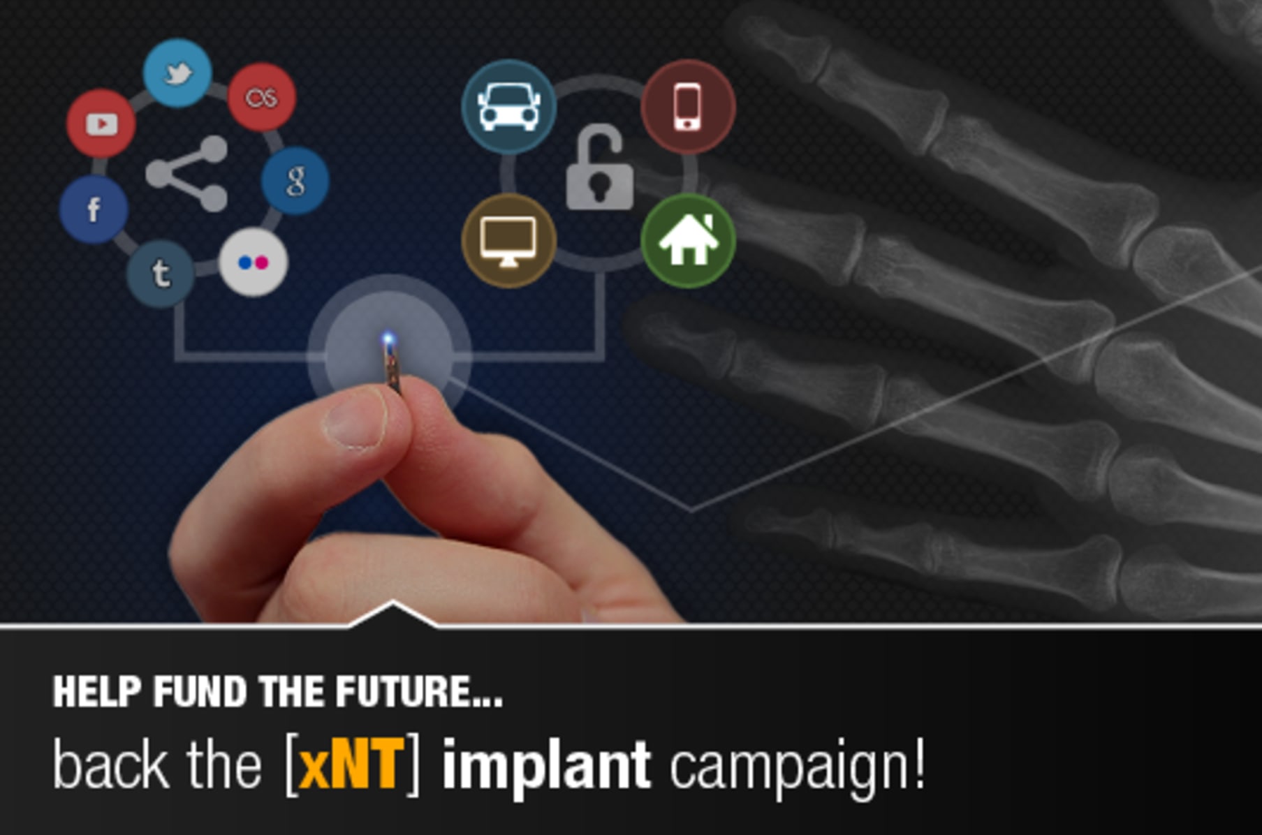 The xNT implantable NFC chip